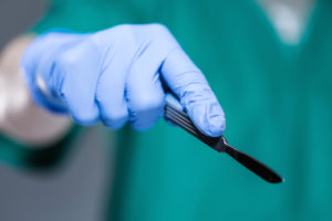 Close-up of hand of doctor holding scalpel