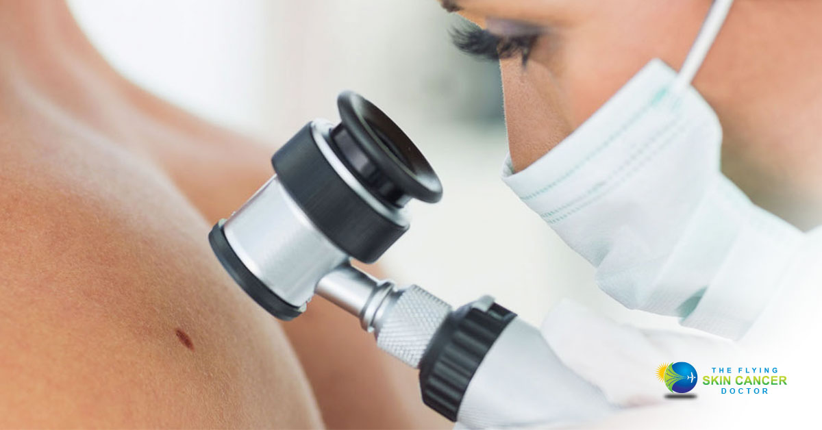 skin checks_the flying skin cancer doctor_ screening_australia
